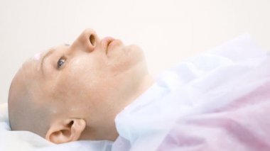 bir klinikte bir doktor ile istişare kel kadın. Trikooloji, onkoloji, alopesi kavramı.