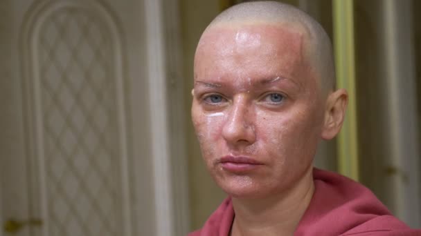 Femme chauve épuisée sur un fond bleu regarde la caméra. elle se sent mal à l'aise à cause de ses cheveux tombants. concept d'oncologie et les effets de la chimiothérapie — Video