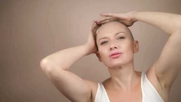 Eine schöne Frau mit Glatze streichelt ihren Kopf und Hals. Kopierraum — Stockfoto
