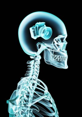 X-Ray fotoğrafik bellek / baş içinde dijital kamera gösteren insan iskeleti x-Ray 3d illüstrasyon