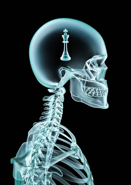 頭の中にチェスピースを示す人間の骨格X線のX線チェス王 3Dイラスト — ストック写真