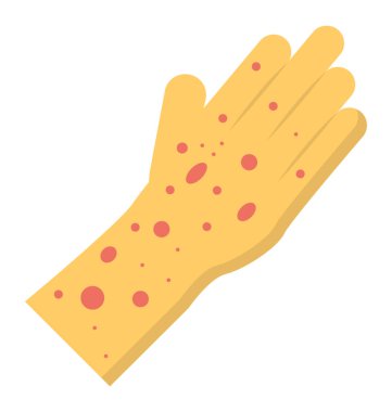 İnsan eli Varisella blister ya da su çiçeği