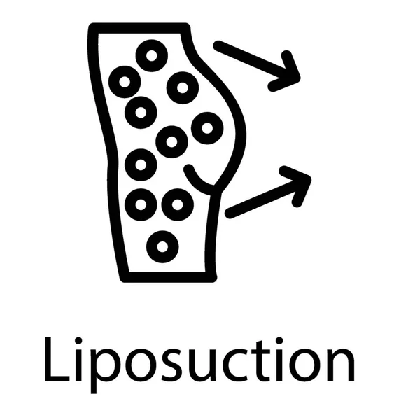 Cirugía Plástica Liposucción Para Bajar Peso — Vector de stock