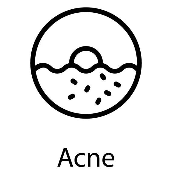 Acné Indésirable Sur Peau — Image vectorielle