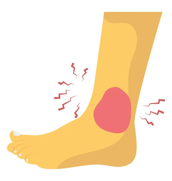 Дизайн Плоскої Піктограми Травми Щиколотки — стоковий вектор