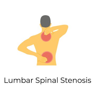 Lomber Spinal stenoz, düz vektör simgesi 