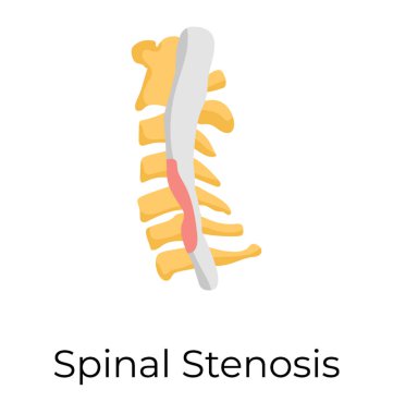 Spinal stenoz, düz vektör simgesi 