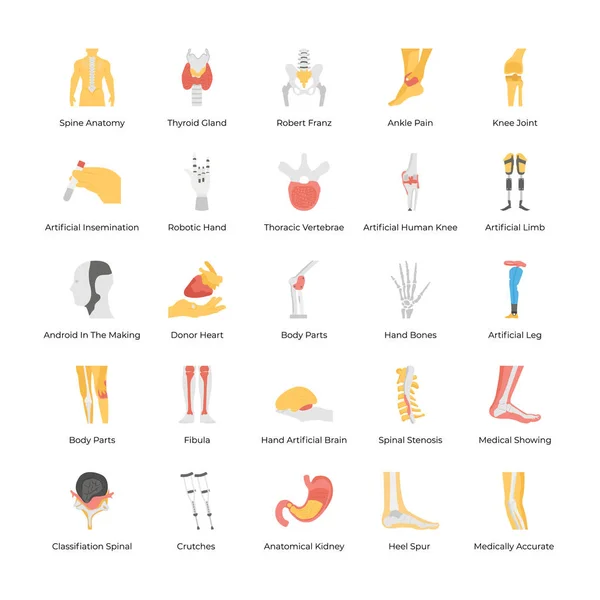 Ensemble Prothèses Orthopédiques Implants Médicaux Pièces Corps Artificielles — Image vectorielle