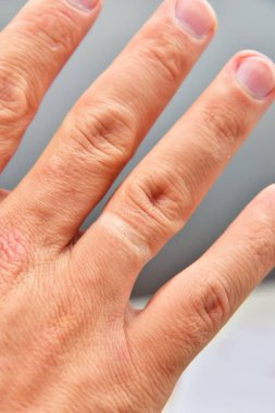 Alyans yüzük parmağına bir izleme. Adam kırdı 