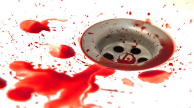  kan drenaj banyo lavabo