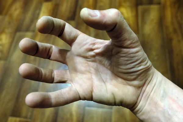Los dedos de la mano del hombre están extrañamente doblados. El tipo quiere llevarse algo. . —  Fotos de Stock