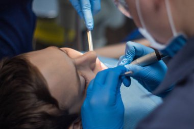 Bir genç diş hekimliğinde tedavi ediyor. Doktor, diş hekimi ve yardımcı'yı hasta kabul kuralları. Yakın çekim el ve tıbbi araçlar.