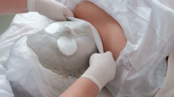 The cosmetologist removes the alginate gray mask from the face of the fat woman. Therapeutic procedure of cleaning and nourishing the skin. Medical center, cosmetology room. Hands in white gloves. — Stock Video