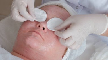 Şevval özçelik güzellik güzellik salonu pamuk tamponlarla gözlerle istemcinin kapatır. Beyaz eldiven yakın çekim elinde. Kalın bir kadın kozmetik merkezinde yüz temizliği için yordam. Sağlık ve güzellik.