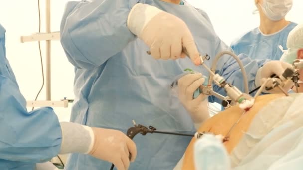 Chirurgische Endoscopische laparoscopie. De camerabeweging van boven naar beneden. Verplaats de focuspunt uit de buik naar de arm. Vingers van een patiënt op de voorgrond met een naald van een druppelaar. Kleine Dof. — Stockvideo