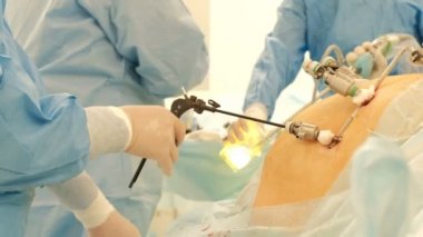 Hastanede ameliyat. Bir takım cerrah hastanın karnına endoskopi gerçekleştirin. Çamaşır ve cerrahi aletlerin dezenfeksiyonu. Yukarıdan aşağıya doğru hareket video kamera yukarıdan. Laparoskopi. Endovideo