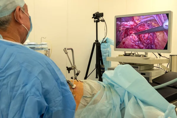 Ameliyathane Cerrahi Hastanesi. Endoskopi. Herhangi bir video kamera ve cerrah canlı yayın kaydı. Görüntüyü Tv ekranına veya yüksek çözünürlüklü ekran hastanın iç organları.