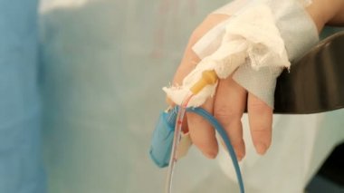 Şişman kadın ameliyat masasında. El video kameradan hareketi için hastanın karın bir damlalık ile. Focus ön plan arka için değiştirin. Endosurgery laparoskopi hastanede.