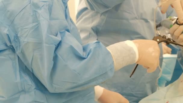 2019 Kostanay Kazahsztán Laparoszkópia Kórházi Közelkép Hasi Műtét Egy Kövér — Stock videók