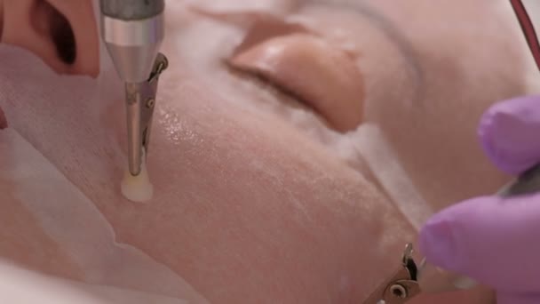 Καλλυντική διαδικασία σχετικά με το γυναικείο πρόσωπο στο σαλόνι ομορφιάς. Αναζωογονητική μάσκα στο πρόσωπο μια γυναίκα. Σούπερ close-up. Αισθητικός χρησιμοποιεί δύο ηλεκτρόδια. — Αρχείο Βίντεο