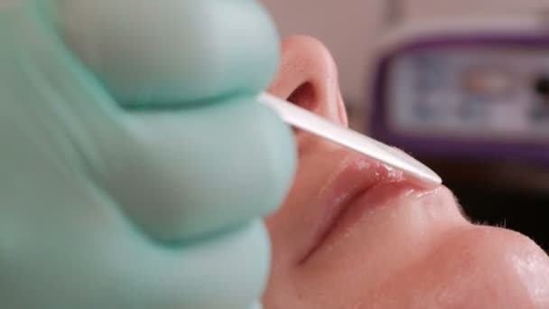 Ένα Beautician Στην Γάντια Τοποθετεί Τζελ Στα Αισθησιακά Χείλη Του — Αρχείο Βίντεο