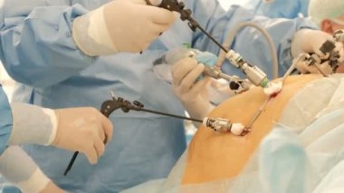 Laparoskopi. Endovideocerrahi. Şişman bir hastanın modern karın ameliyatı. Doktor cerrah aleti değiştirir.