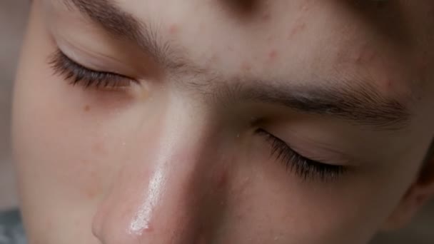 Epileren Tiener Kerel Bij Cosmetologie Procedure Van Ontharing Tussen Wenkbrauwen — Stockvideo