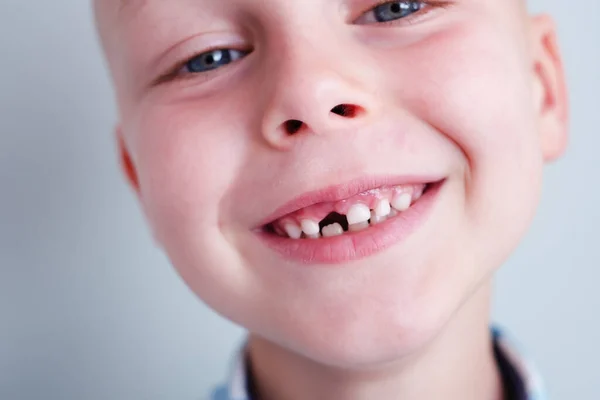 Baby Smile Upper Baby Tooth Hole Child Smile Cheerful Concept Stock Picture