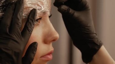 Kaş kapağı prosedürü yakın çekim