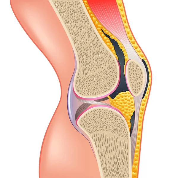 Gezamenlijke Anatomie Knie Geïsoleerd Witte Fotorealistische Vectorillustratie — Stockvector