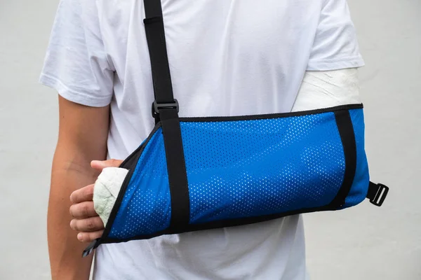 Man with broken arm wrapped medical cast plaster and blue bandage. Fiberglass cast covering the wrist, arm, elbow after sport accident, isolated on white