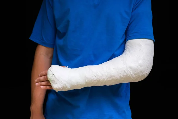 Homem com o braço partido embrulhado gesso fundido médico. Molde de fibra de vidro cobrindo o pulso, braço, cotovelo após acidente desportivo, isolado em preto — Fotografia de Stock