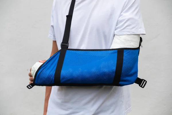 Man with broken arm wrapped medical cast plaster and blue bandage. Fiberglass cast covering the wrist, arm, elbow after sport accident, isolated on white