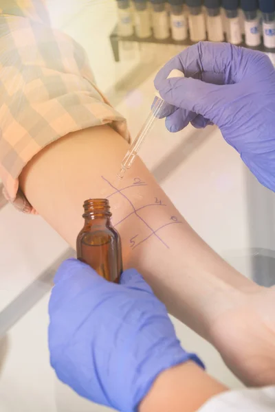 Allergy tests in laboratory — Stock Photo, Image