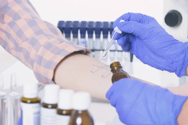 Lékař Dělá Alergické Testy Laboratoři — Stock fotografie