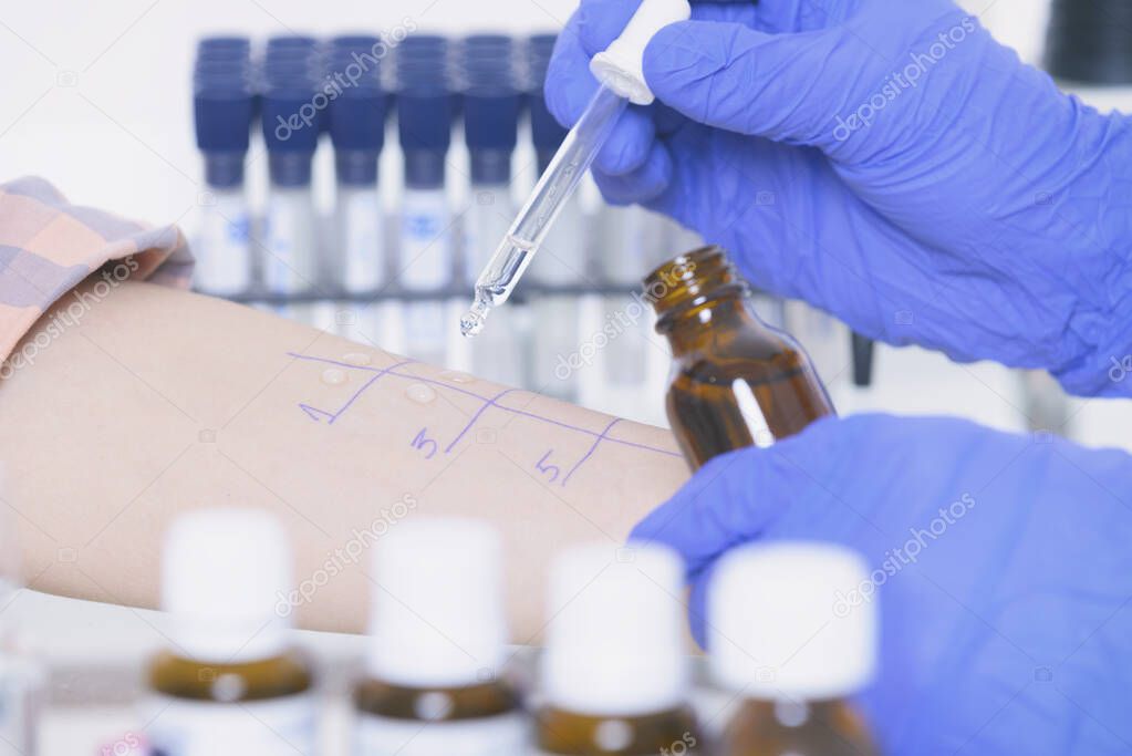 Medical doctor doing allergy tests in laboratory