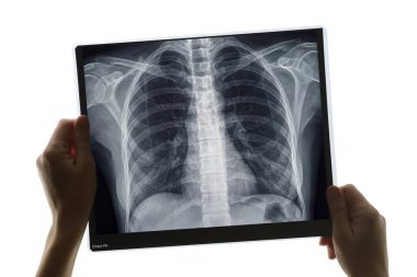 Examination of a chest x-ray  clipart