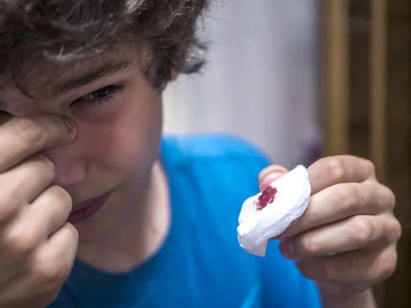 Close Rosto Adolescente Com Sangramento Sangue Nariz — Fotografia de Stock