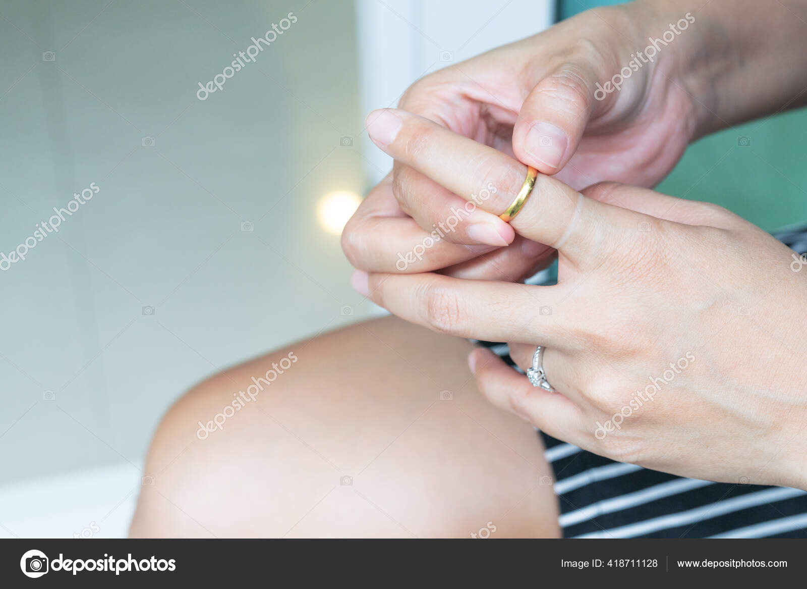 Stuck Ring Take Fat Woman Nail Gold Ring Removing — Stock Photo