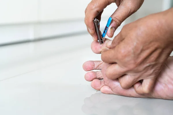 Nail Clipping Senior Woman Foot Cutting Nails Using Nail Clipper — Stock Photo, Image