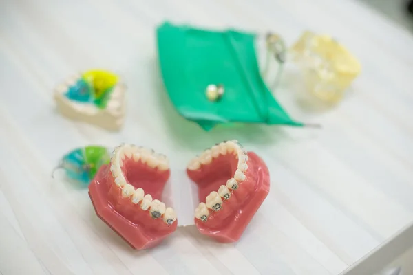 Orthodontic teeth models dental education model jaws with half ceramic and half metal bracket Teeth and Jaw Models.