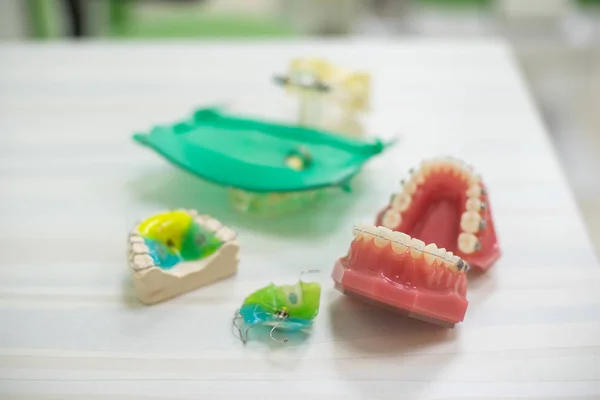 Ortodoncia modelos de dientes modelo de educación dental mandíbulas con medio soporte de cerámica y medio metal Dientes y modelos de mandíbula . — Foto de Stock