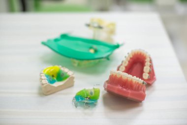 Ortodontik diş modelleri diş eğitim modeli jaws ile yarım seramik ve yarım metal braketi diş ve çene modelleri.