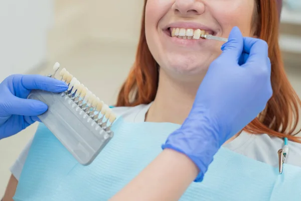 Verifique e selecione a cor dos dentes na cadeira do dentista. Dentista faz o processo de tratar uma bela jovem ruiva. Seleção de um implante dentário. Close-up . — Fotografia de Stock