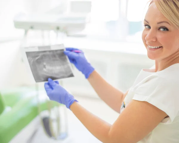 Dentista feminina a fazer uma radiografia dentária. A enfermeira segura um raio-X da mandíbula humana e aponta para um dente com cárie. Consultório de Periodontistas . — Fotografia de Stock