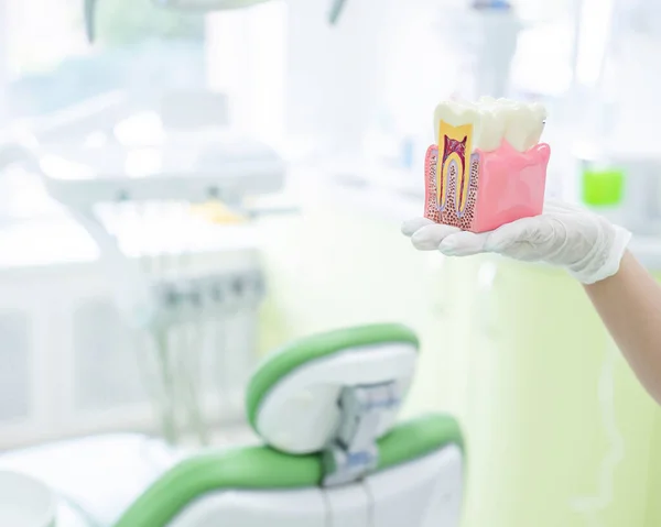 Anatomia di un modello dentale concetto di sezione trasversale dentista per l'istruzione. Il dentista tiene un dente finto in sezione nello studio . — Foto Stock