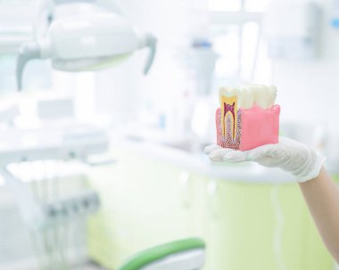 Anatomy of a dental model concept of a dentist cross section for education. The dentist holds a mock tooth in section in the office.