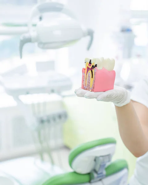 Anatomy of a dental model concept of a dentist cross section for education. The dentist holds a mock tooth in section in the office.