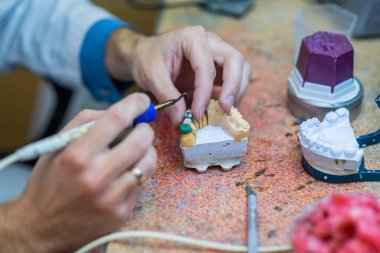 Bir diş teknisyeni kısmi takma diş yapar. Takma diş ya da diş köprüsü üretimi. Yakın plan..