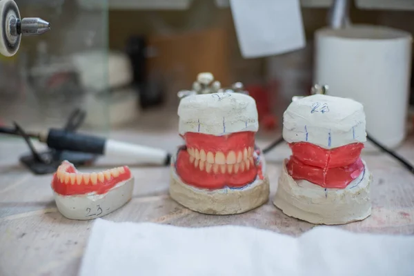 Fundición de dientes humanos para implantes. Mandíbula de cerámica. Taller para técnico dental . — Foto de Stock